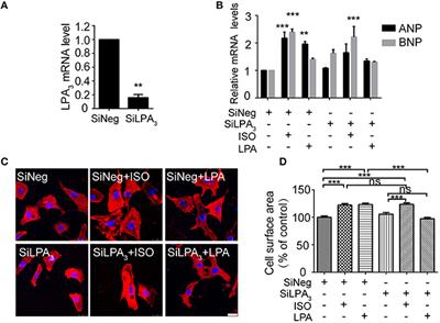 Protective Role for LPA3 in Cardiac Hypertrophy Induced by Myocardial Infarction but Not by Isoproterenol